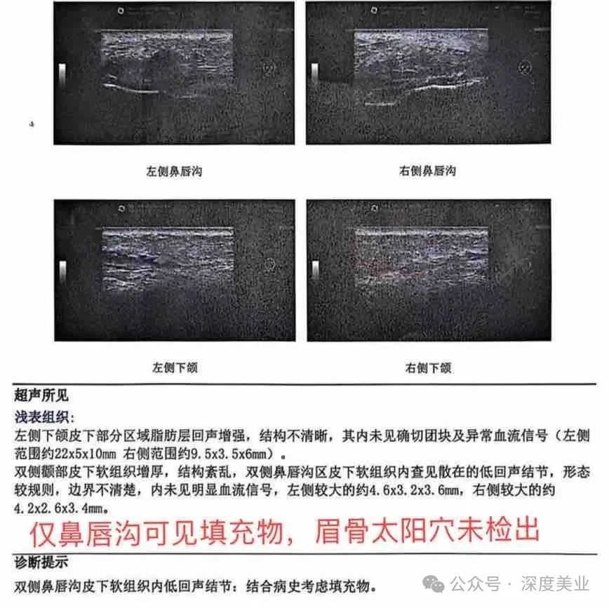 %title插图%num 图片