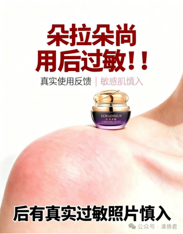 “脸肿到睁不开眼”，朵拉朵尚竟要医院开“质检报告”？-一洼田